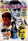 LA MANOS DE ORLAC